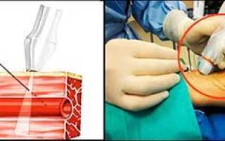 9 полезных свойств рапсового масла для здоровья и красоты